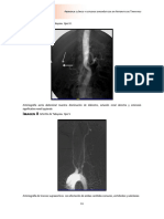 AbordajeclínicoyestudiosdiagnósticosenArteritisdeTakayasuAbordajeclínicoyestudiosdiagnósticosen - PDF Pagina 49