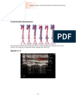 AbordajeclínicoyestudiosdiagnósticosenArteritisdeTakayasuAbordajeclínicoyestudiosdiagnósticosen - PDF Pagina 46