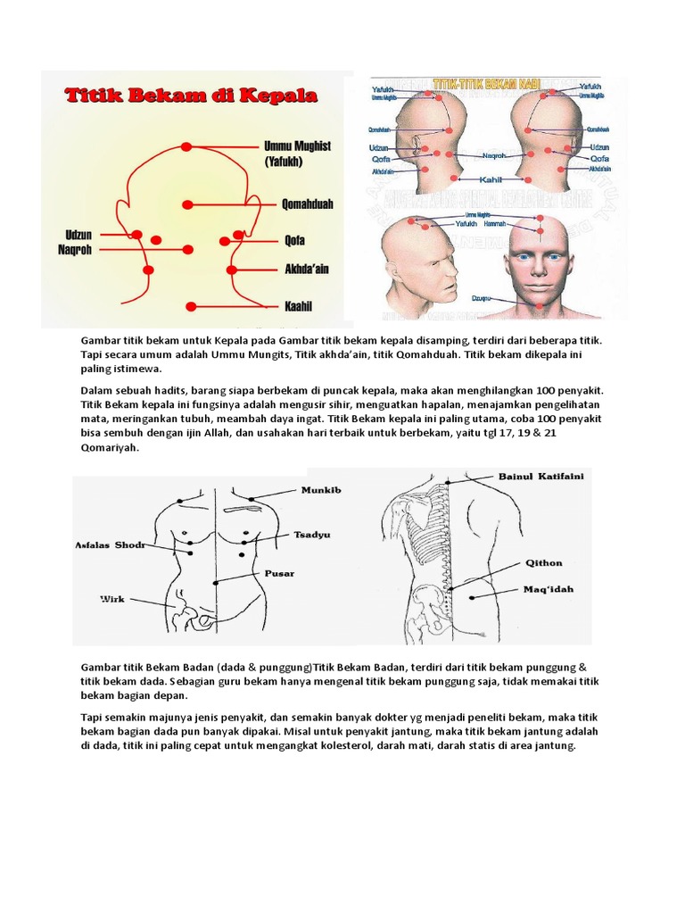 Gambar Titik Bekam | PDF