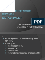 Retinaldetachment 170518024801