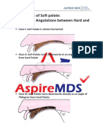 Aspire MDS - Soft Palate Classification