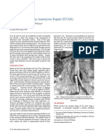 Endovascular Aortic Aneurysm Repair (EVAR) rf