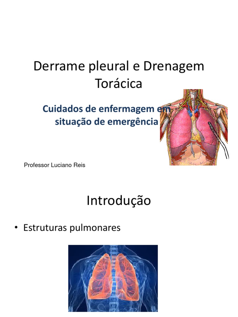 Drenagem de Derrame Pleural: Cuidados e Indicações | PDF ...