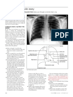 Chest X-Rays Made Easy: A Guide to Reading Chest Radiographs