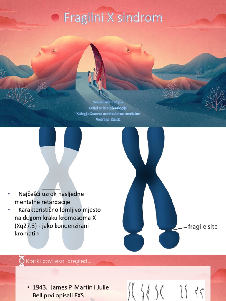 Fragile X Syndrome | PDF