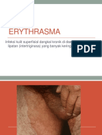 Eritrasma 