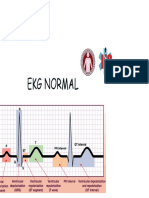 Chapter 17 EKG Normal
