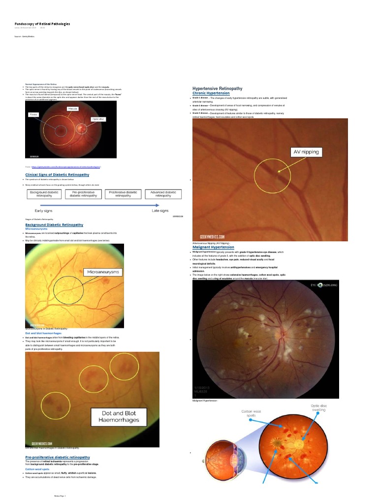Understanding Retinal Pathologies Guide | PDF | Retina | Glaucoma