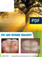 Pit and fissure sealants for caries prevention