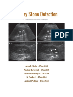 Kidney Stone Detection