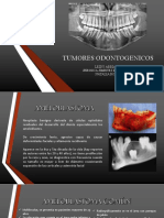 Tumores Odontogenicos