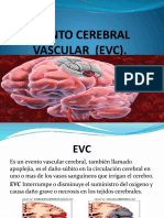 Evento Cerebral Vascular (Evc)