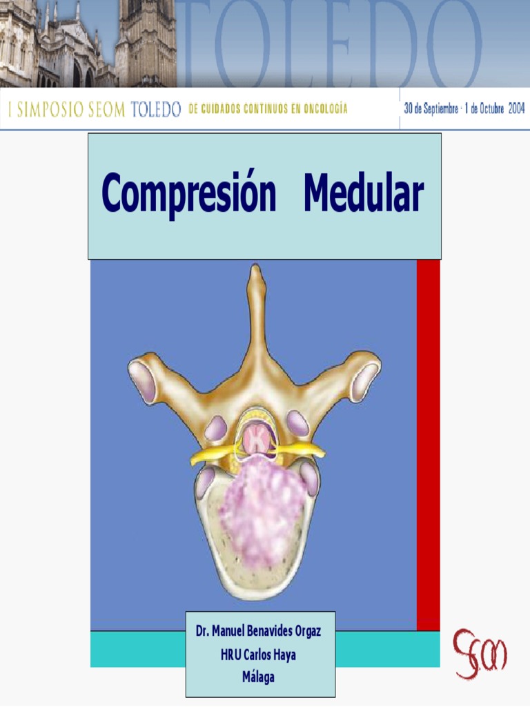 Compresión Medular y Metástasis Meningea | PDF | Metástasis | La ...