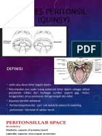 Abses Peritonsil (Quinsy)