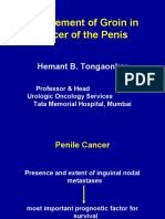 Management of Groin in Cancer of The Penis: Hemant B. Tongaonkar