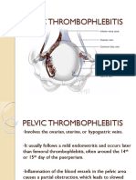 Pelvic Thrombophlebitis