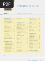 Download Chapter 07 Arthroplasty of the Hip by Suhail Arshad SN44711611 doc pdf