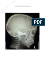 Kritisi Cranium Lateral