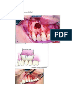 Macam-macam flap oral dan prinsip desainnya