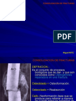9consolidacinfracturas 160526161551 PDF