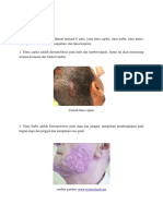 makalah dermatofitosis.docx