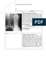 (Asma Awaliyah) Laporan Biomekanik Lumbal Spine