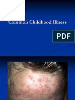 Common Childhood Illness