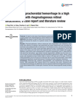 Spontaneous Suprachoroidal Hemorrhage in High Myopia With Rhegmatogenous Retinal Detachment