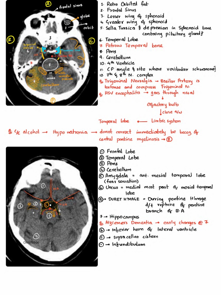 Elite Radiology Samples | PDF