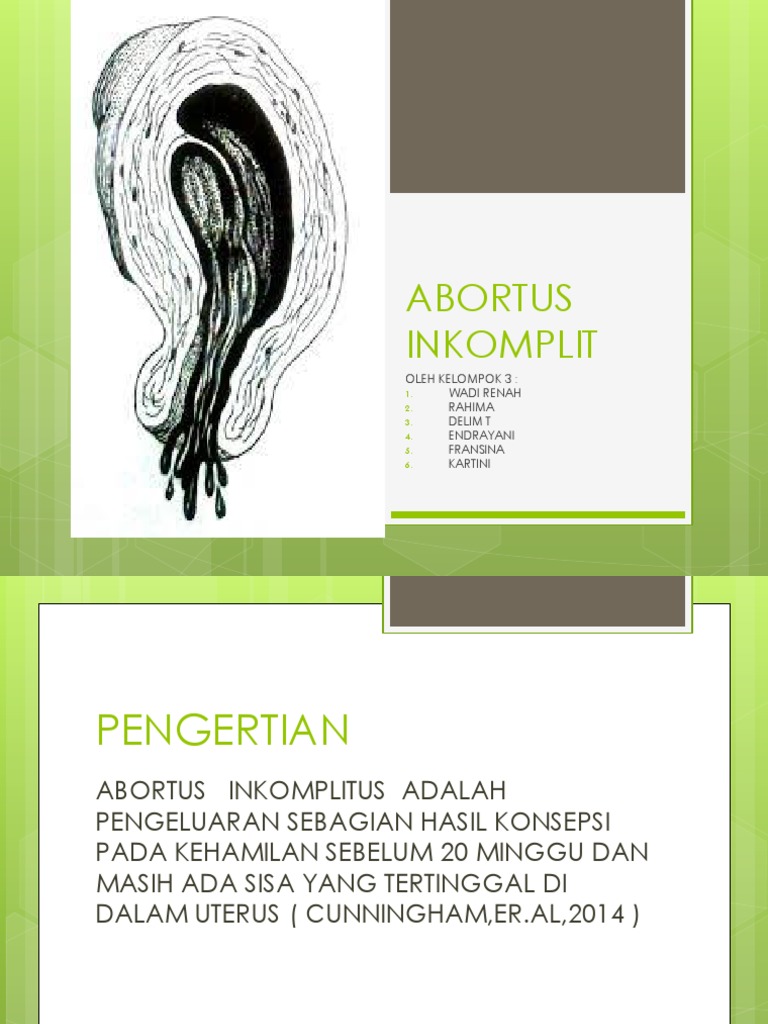 Abortus Inkomplit Power Poin | PDF | Sains & Matematika