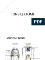 Tonsilitis Kronis