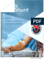 AV Shunt PDF