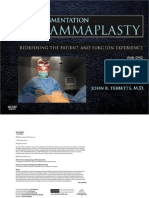 Augmentation Mammaplasty