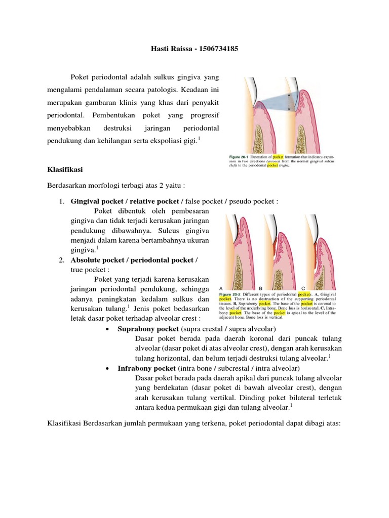 Periodontal Pocket | PDF | Seni & Disiplin Bahasa