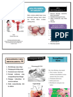 Leaflet Kista Ovarium