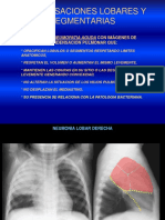 07.segmentacion Bronq - Pulmonar Radiologia