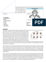 Laminectomy.pdf