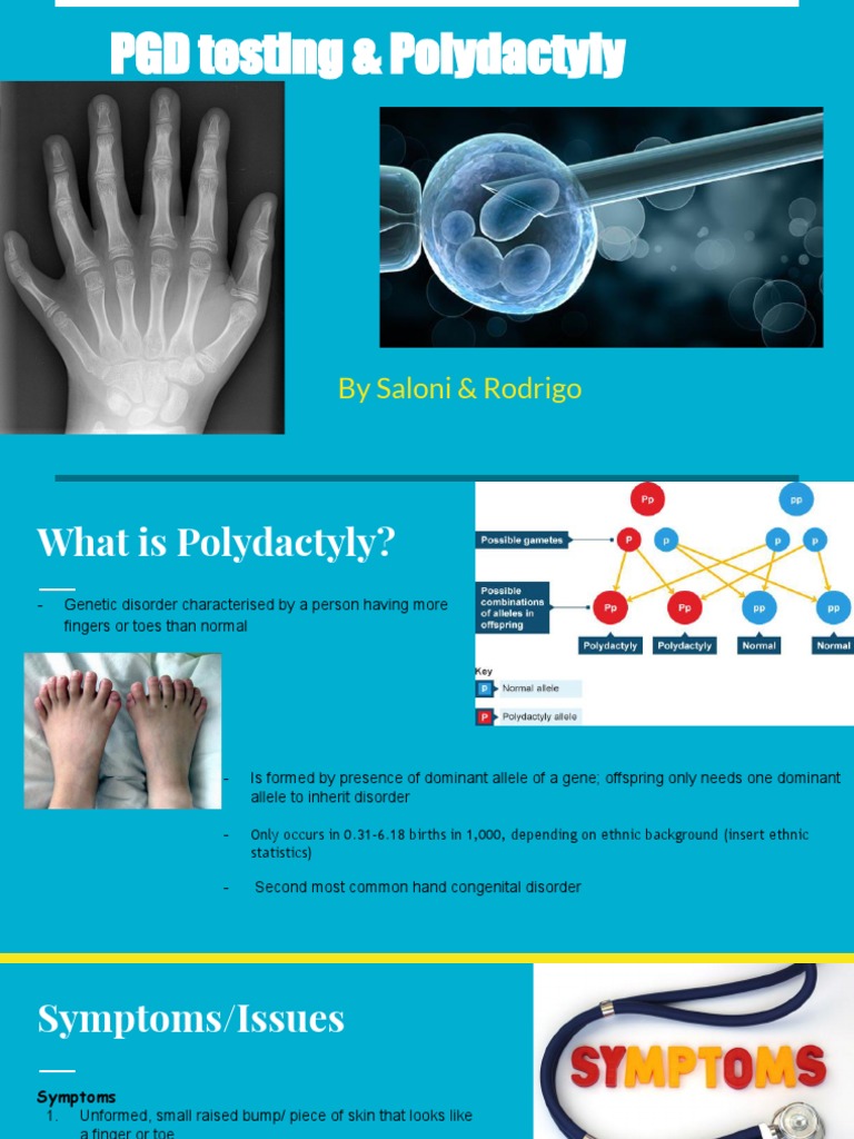 Polydactyly and PGD Testing Overview | PDF