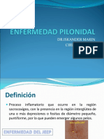 Enfermedad Pilonidal