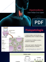 Hipotiroidismo: Menos de