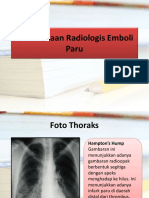 Dokumen - Tips - Pemeriksaan Radiologis Emboli Paru