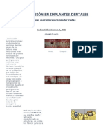 Alta Precisión en Implantes Dentales