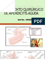 Tratamiento Quirurgico de La Apendicitis Aguda