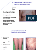 How Do I Know If My Patient Has Urticaria?: The Clinical Features of Urticaria