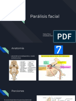 Parálisis Facial