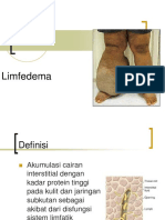 Limfedema