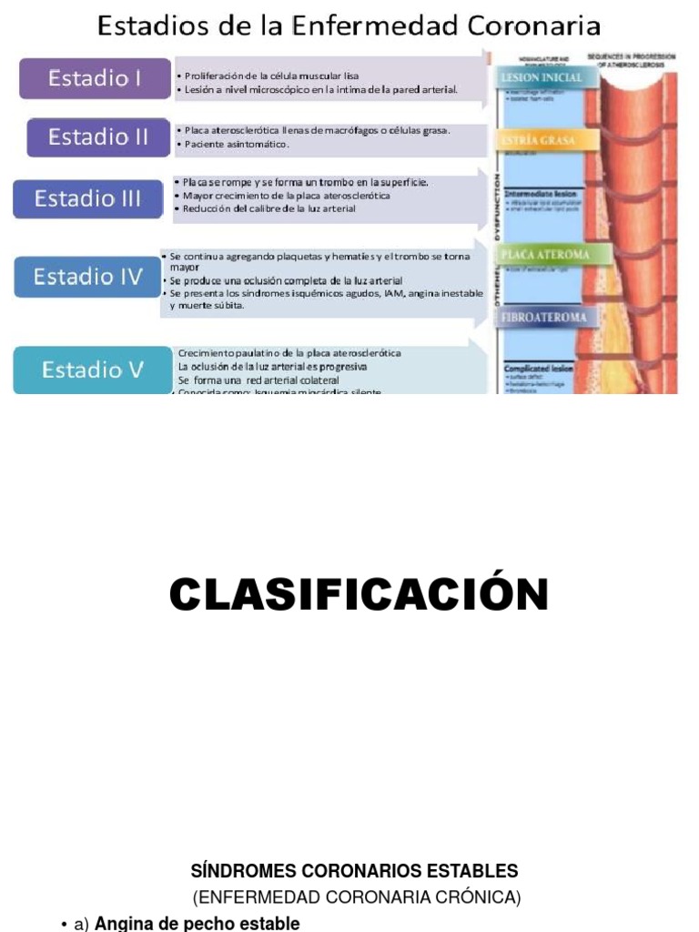 Clasificacion y DX de Enfermedad Coronaria | PDF | Infarto de miocardio ...