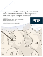 step-by-step-guide---minimally-invasive-lumbar-spine-decompression-and-dural-repair