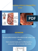 Colitis Ulcerosa Crónica Idiopatica