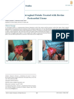 A Case of Rectovaginal Fistula Treated With Bovine Pericardial Tissue 130